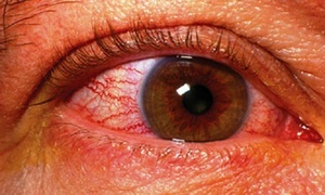 Особенности лечения атрофии зрительного нерва