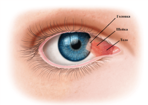 Строение глаза и развитие птеригиума на глазу