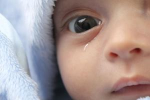 Закисают глаза у ребенка 1 год лечение thumbnail
